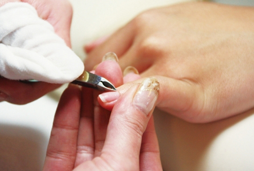 nail